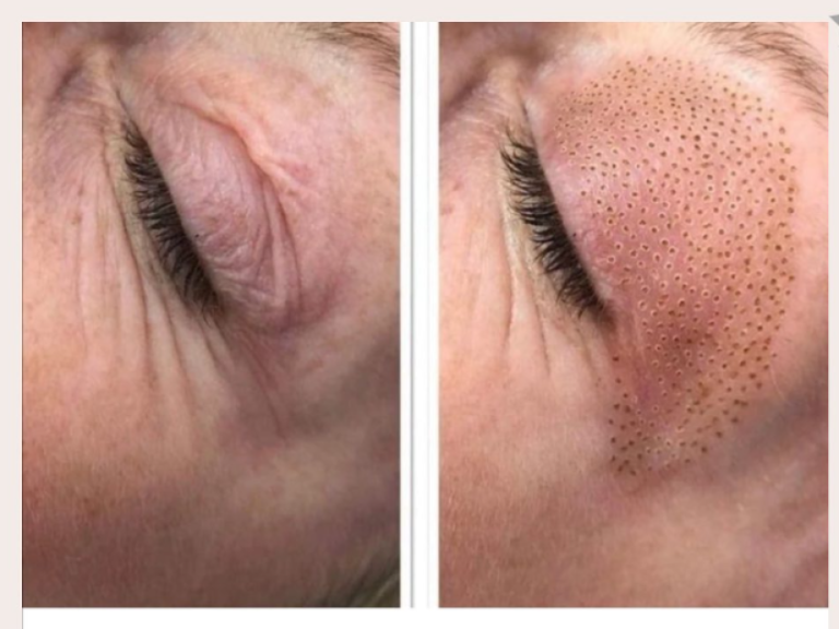 22.09.27.11.19 1664270345.7212 6720878 768x576