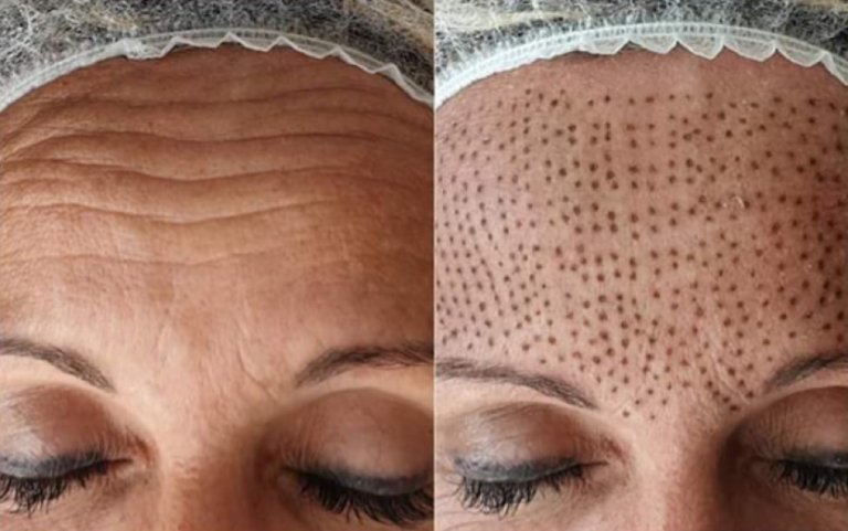 22.09.27.11.19 1664270346.8049 31722000 768x481