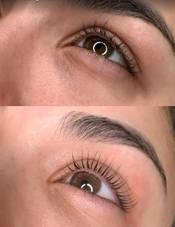 1-35